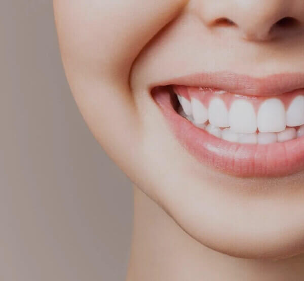 Teeth Whitening Cost In Shyamal